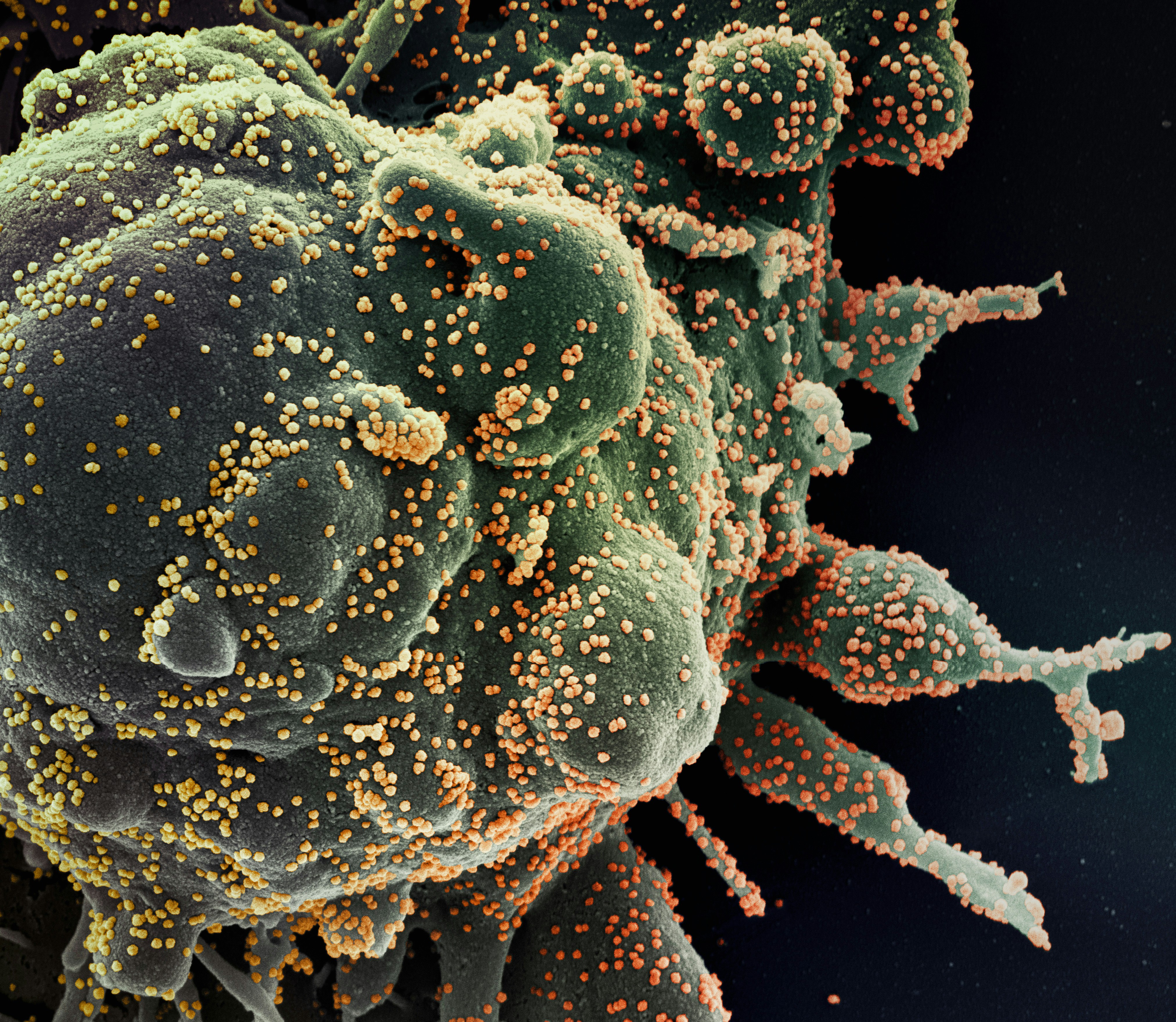 Tudriqev Works by Replicating Inside Tumors to Trigger an Immune Response