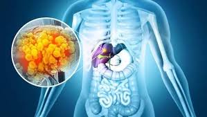 A Liver-Targeted Drug Cuts Proteinuria in IgA Nephropathy